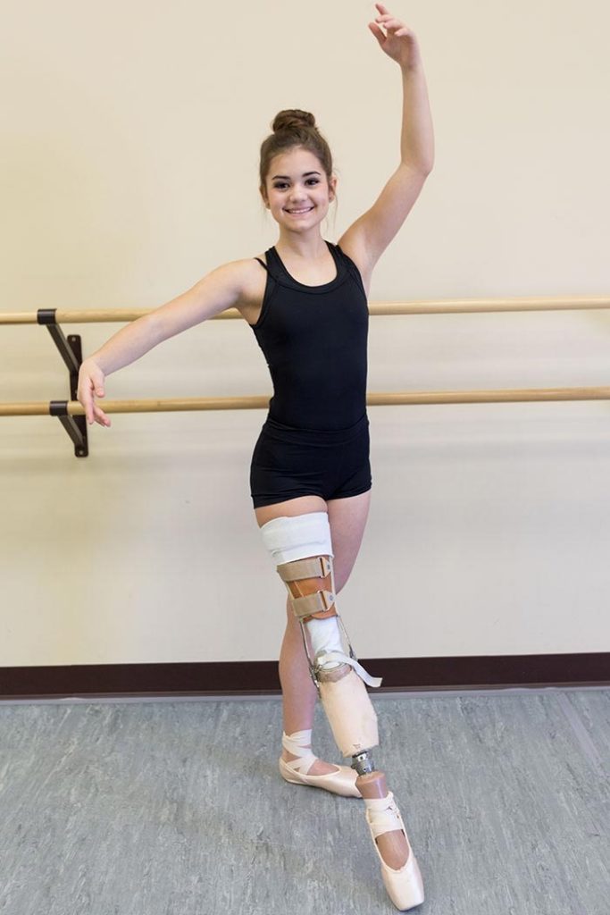 girl-lost-leg-cancer-not-say-goodbye-dream-becoming-ballerina-2